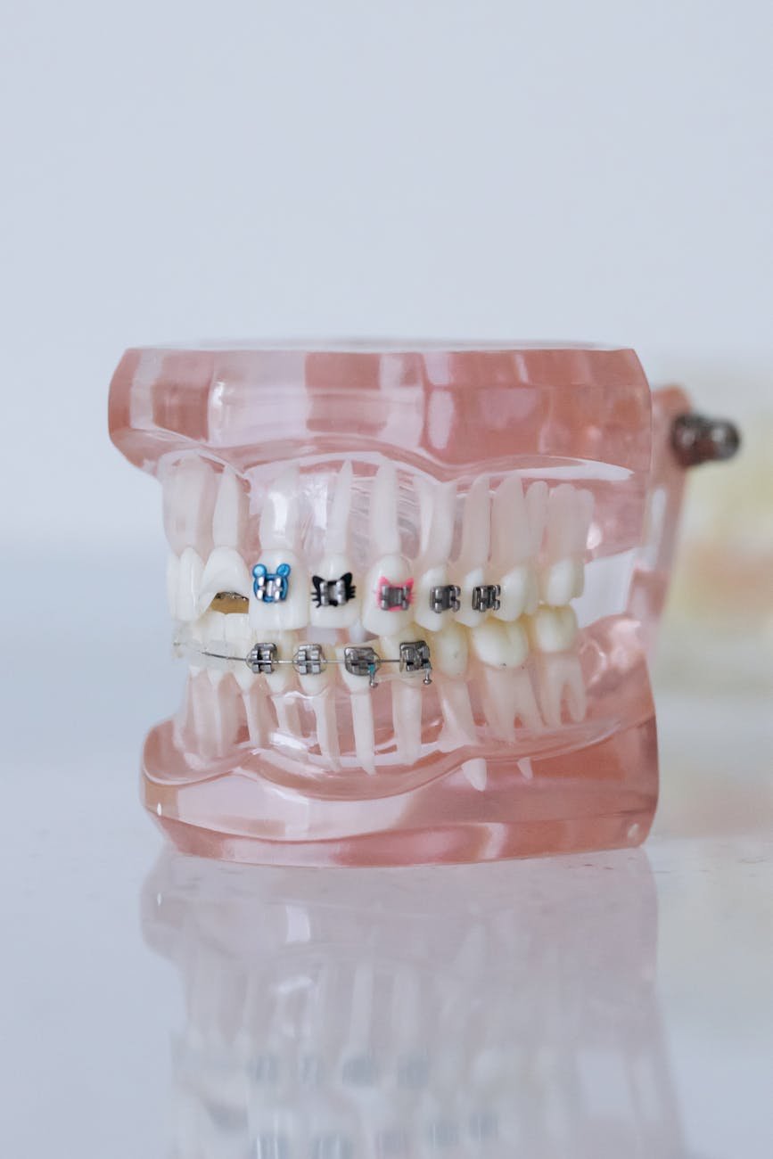 Sai Prasad’s Dental for braces treatment Kadapa illustration for Sai Prasad’s Dental Best Braces Treatment Kadapa – Stunning