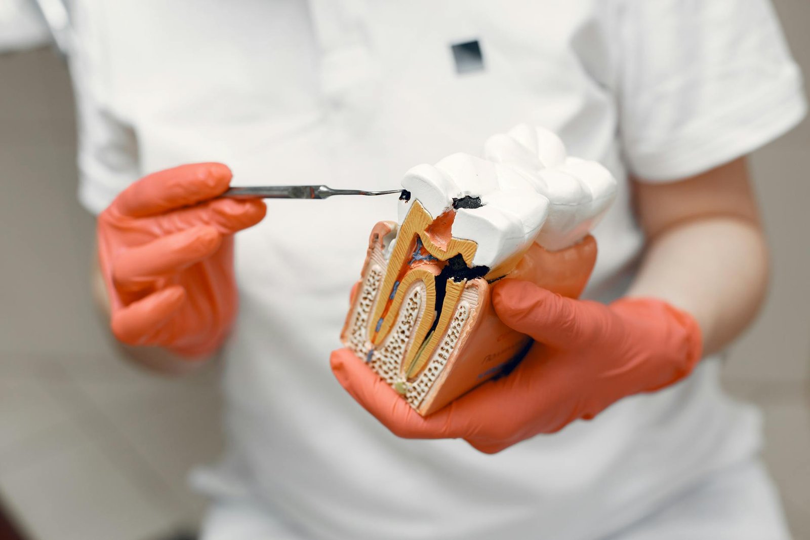 Illustration of Sai Prasad’s Dental for Root Canal Treatment Kadapa: Exclusive Expert Care