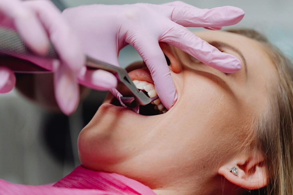Illustration of Dental Problems Kadapa: Must-Have Oral Care Tips to Avoid Tooth Decay